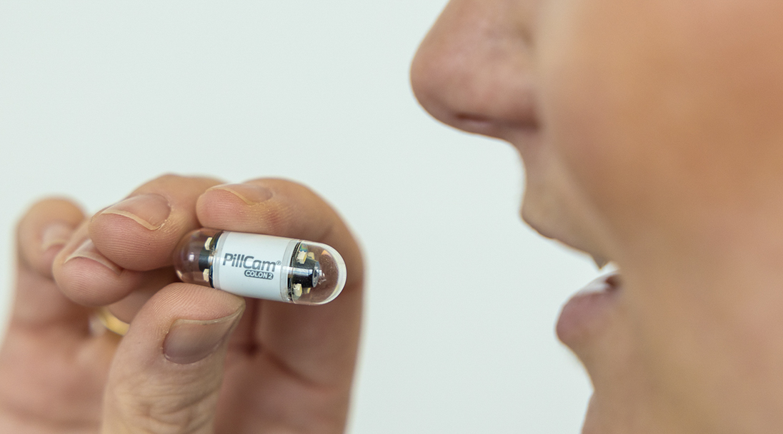  capsule endoscopy  in HAL kolar chintamani
